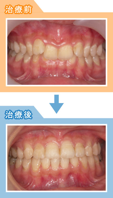 治療例